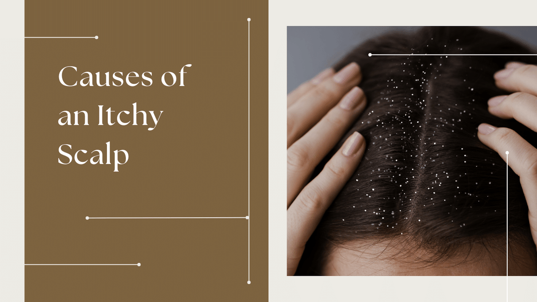 Causes of an Itchy Scalp 