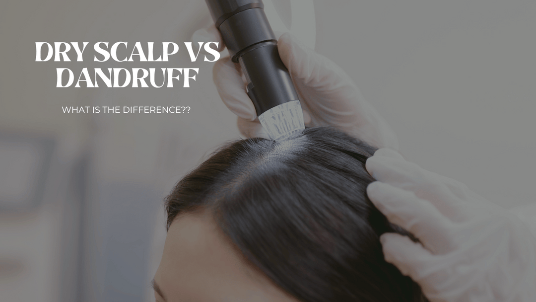 Dandruff Vs. Dry Scalp, What is the Difference?