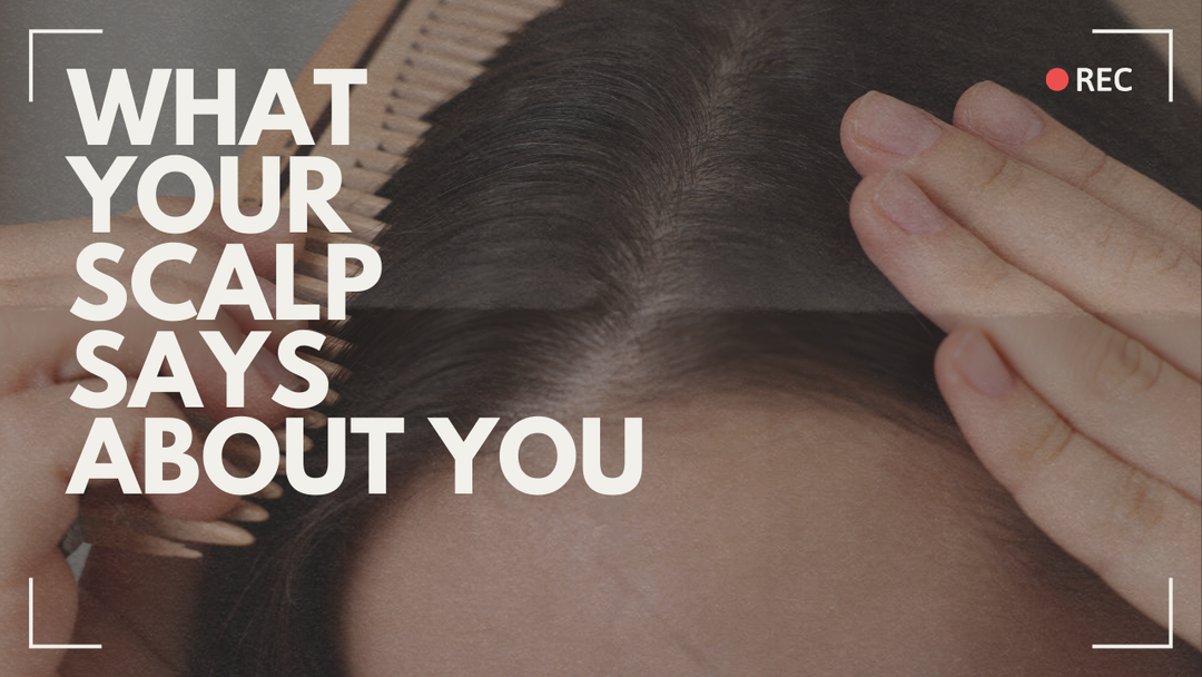 What Your Scalp Really Says About You .. How Holistic Health Can Help.